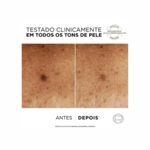 L’Oréal Bright Reveal Niacinamida + Amino Sulfónico Sérum manchas escuras - Image 6