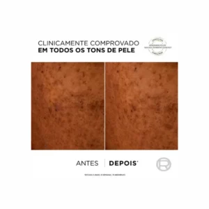 L'Oréal Bright Reveal Niacinamida + LHA Fluído antimanchas SPF50+ - Image 6