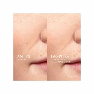 Lancôme Rénergie HCF Triple Serum - Image 4