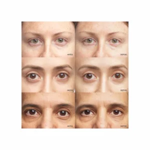 Clinique All About Eyes Brightening Serum Concentrate Retinoid + Vit C + HA - Image 8